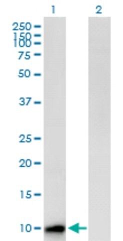 Anti-CST8 antibody produced in mouse