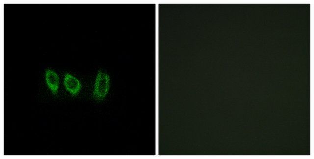 Anti-CSTL1 antibody produced in rabbit