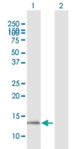 Anti-CST1 antibody produced in mouse