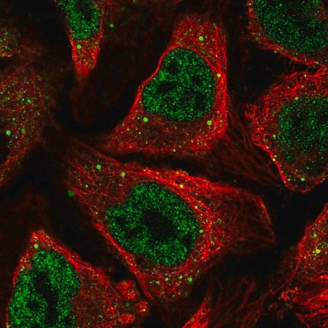 Anti-CSRNP1 antibody produced in rabbit