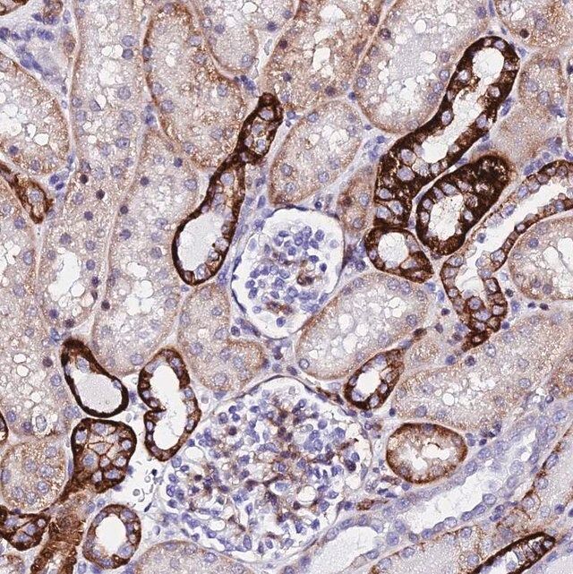 Anti-CSRP2 antibody produced in rabbit