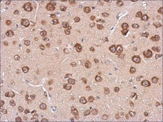 Anti-CST7 antibody produced in rabbit