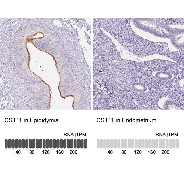 Anti-CST11 antibody produced in rabbit