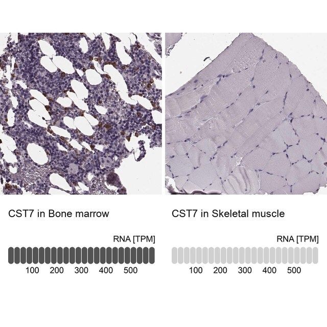 Anti-CST7 antibody produced in rabbit