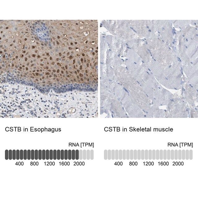 Anti-CSTB antibody produced in rabbit