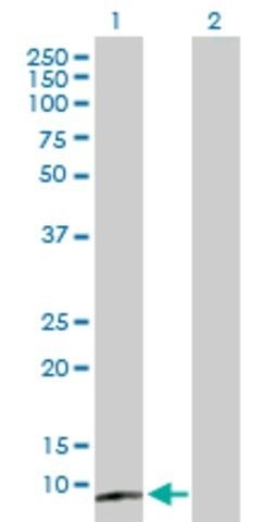 Anti-CST5 antibody produced in mouse