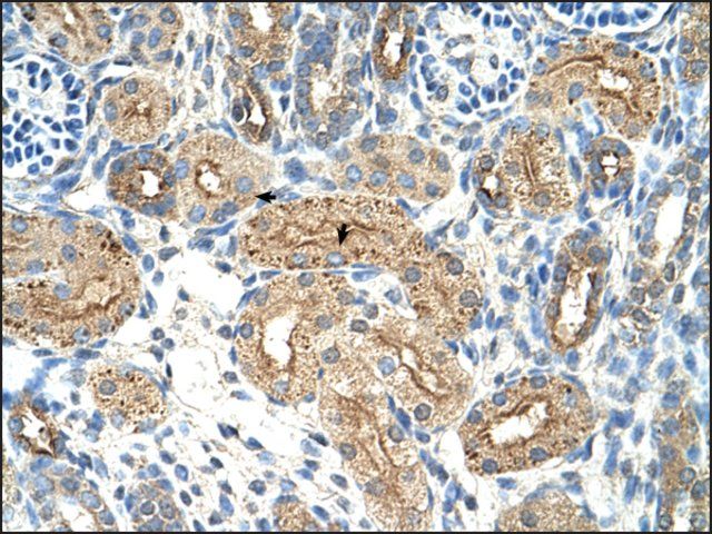 Anti-CTDSPL antibody produced in rabbit