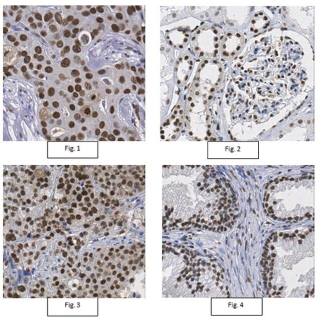 Anti-CtBP-2 Antibody