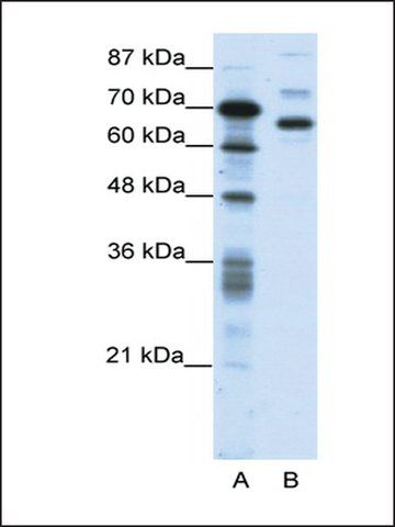 Anti-CTCFL antibody produced in rabbit