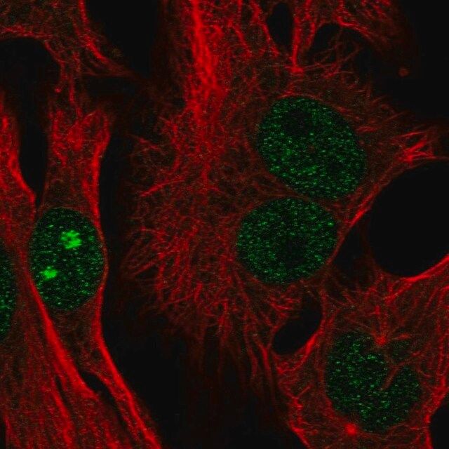 Anti-CTC-534A2.2 antibody produced in rabbit