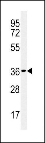 ANTI-CTDSPL (N-TERM) antibody produced in rabbit