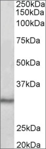 Anti-CTDSP1 antibody produced in goat