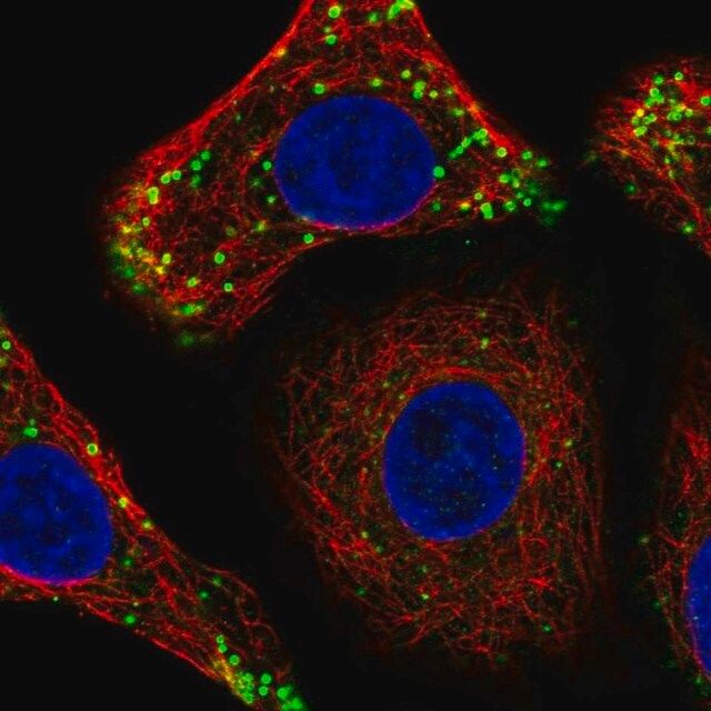 Anti-CTDNEP1 antibody produced in rabbit