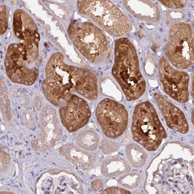 Anti-CTDSP2 antibody produced in rabbit