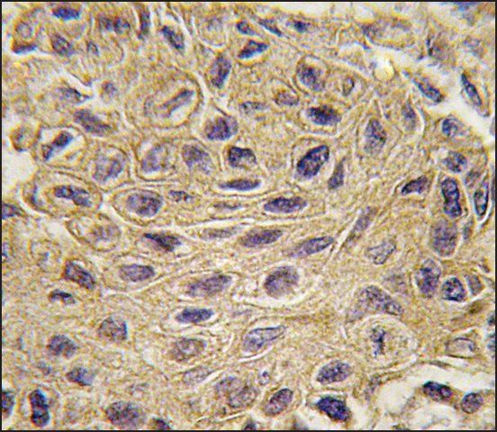 Anti-CTGF (center) antibody produced in rabbit