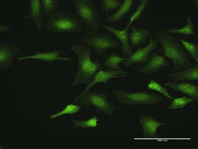 Anti-CTDSP2 antibody produced in rabbit