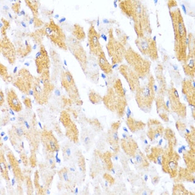 Anti-CTGF antibody produced in rabbit