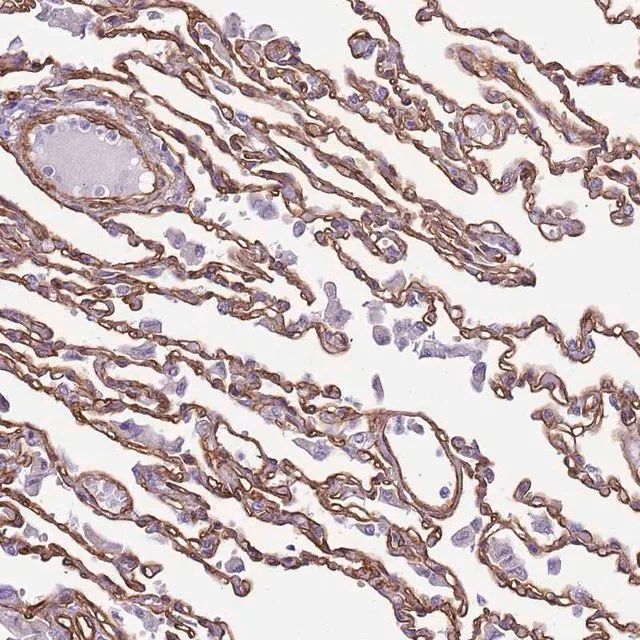 Anti-CTDSPL antibody produced in rabbit