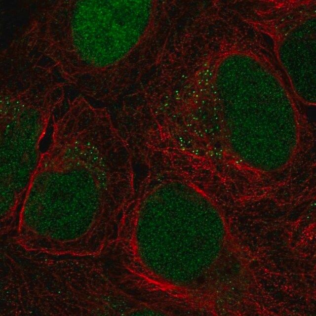 Anti-CTDP1 antibody produced in rabbit