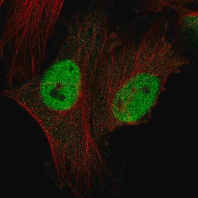 Anti-CTDSPL2 antibody produced in rabbit