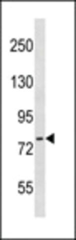 ANTI-CTEN(N-TERMINAL) antibody produced in rabbit