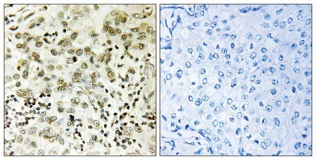 Anti-CTDSP1 antibody produced in rabbit