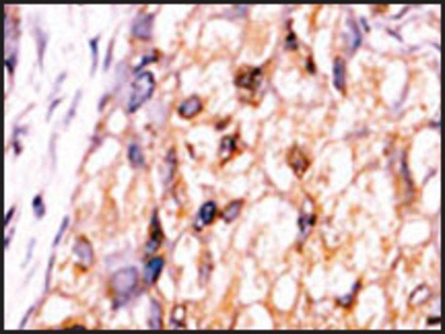 Anti-CTDSP1-V250 (C-term) antibody produced in rabbit