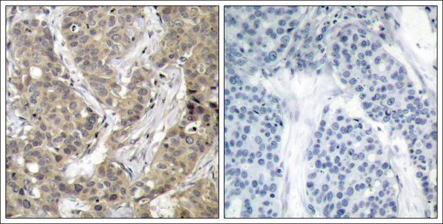 Anti-CTNNB1 (Ab-37) antibody produced in rabbit