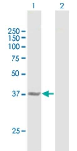 Anti-CTH antibody produced in mouse