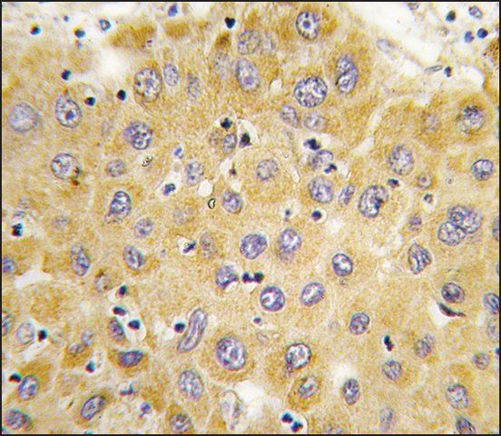 Anti-CTGF (C-term) antibody produced in rabbit