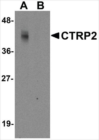 Anti-CTRP2 (ab2) antibody produced in rabbit