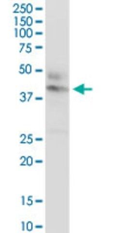 Anti-CTNS antibody produced in rabbit