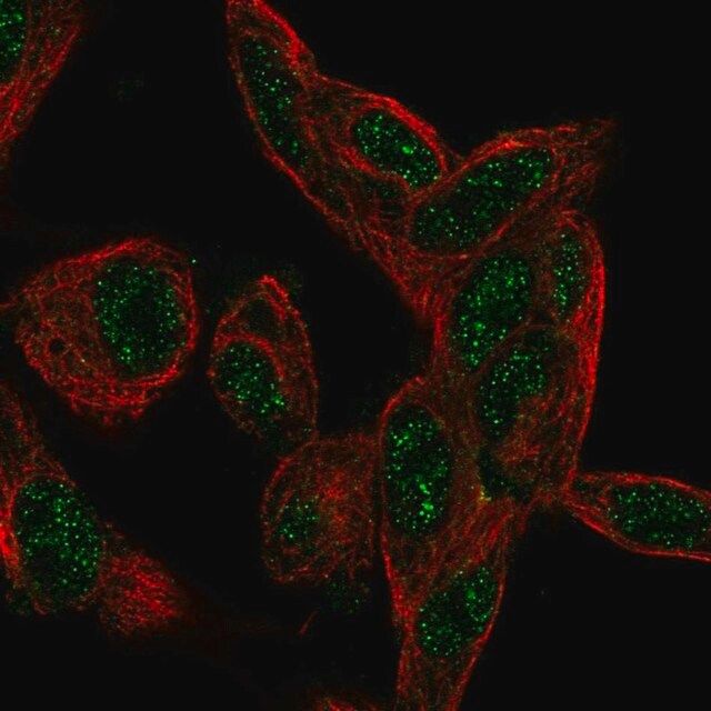 Anti-CTDSP1 antibody produced in rabbit