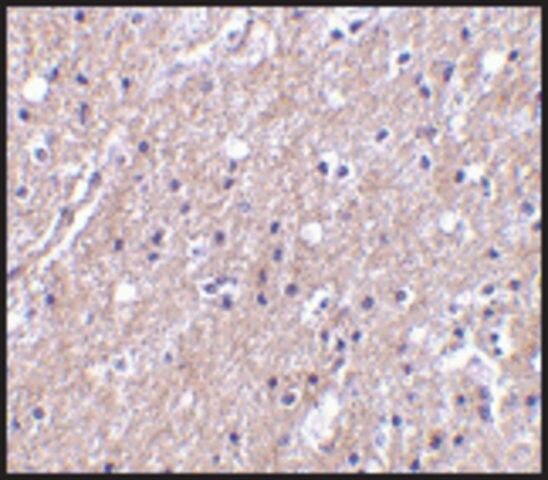 Anti-CTRP6 antibody produced in rabbit