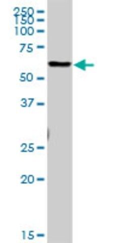 Anti-CTSL1 antibody produced in rabbit