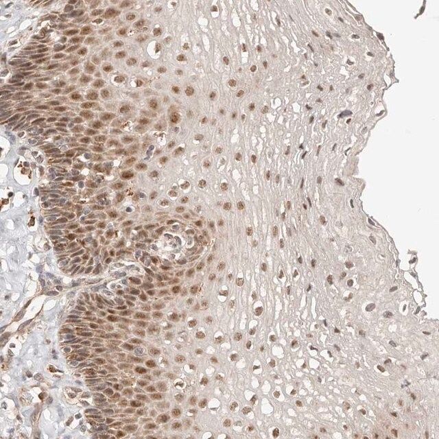 Anti-CTNNBL1 antibody produced in rabbit