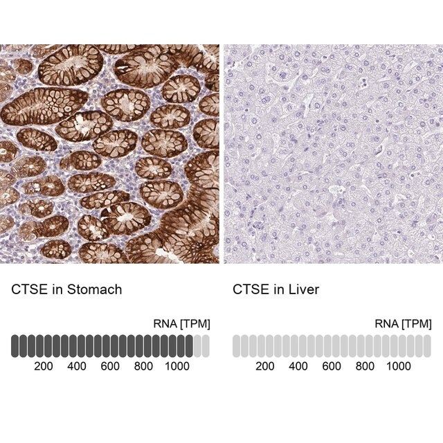 Anti-CTSE antibody produced in rabbit