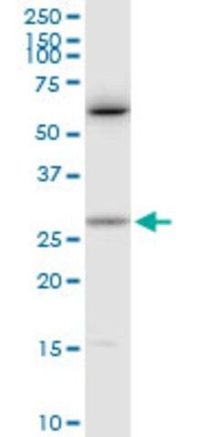 Anti-CTF1 antibody produced in rabbit