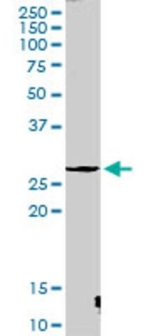 Anti-CTSG antibody produced in rabbit