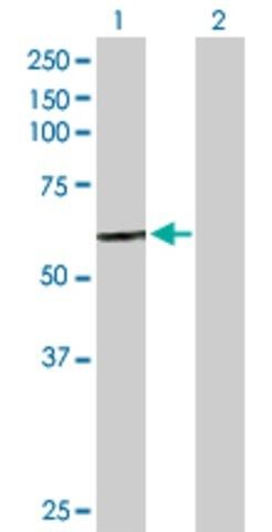 Anti-CTSC antibody produced in rabbit