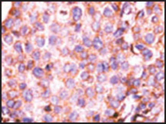 Anti-CTDSP1 (N-term) antibody produced in rabbit