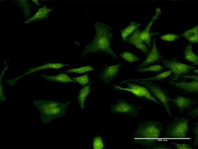 Anti-CTNND1 antibody produced in rabbit