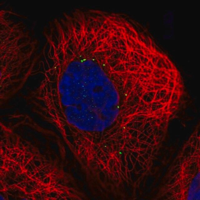 Anti-CTNS antibody produced in rabbit