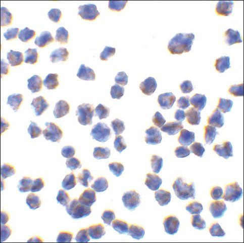 Anti-CTRP7 (ab3) antibody produced in rabbit