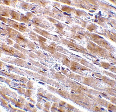 Anti-CTRP3 antibody produced in rabbit