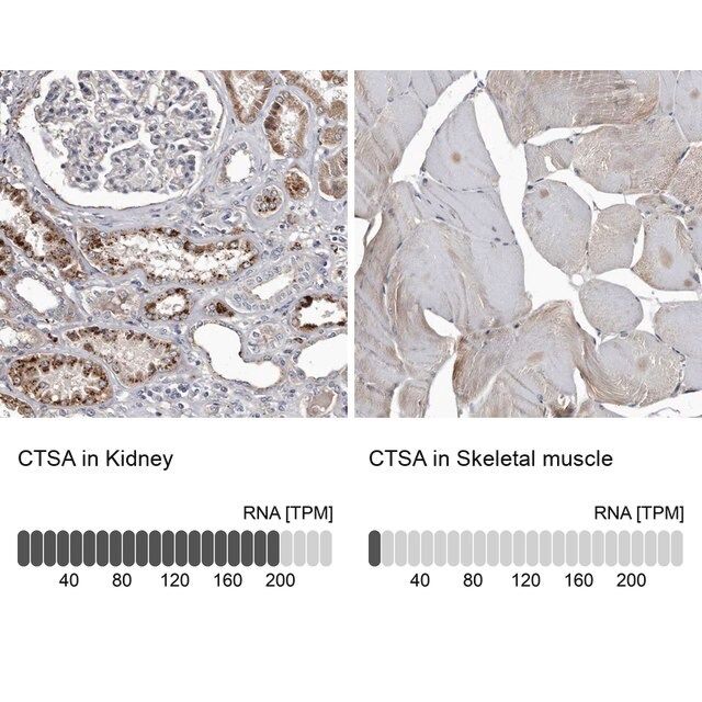 Anti-CTSA antibody produced in rabbit