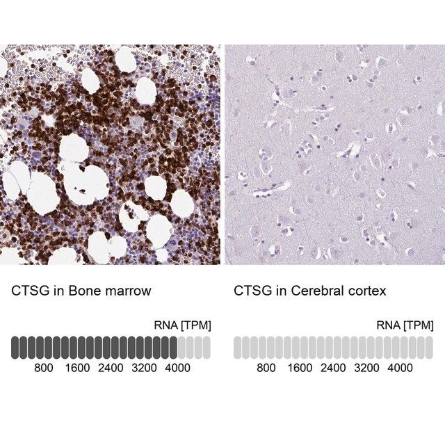 Anti-CTSG antibody produced in rabbit