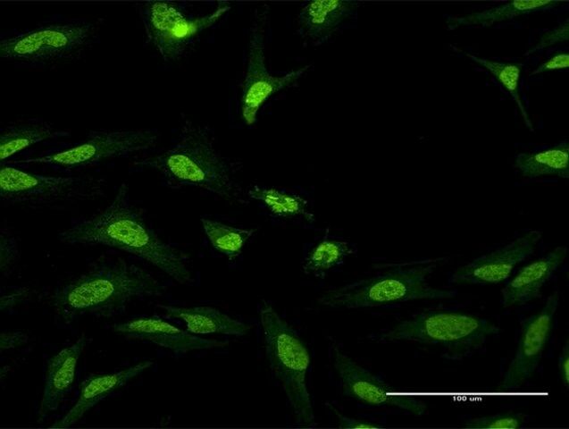 Anti-CUGBP1 antibody produced in mouse