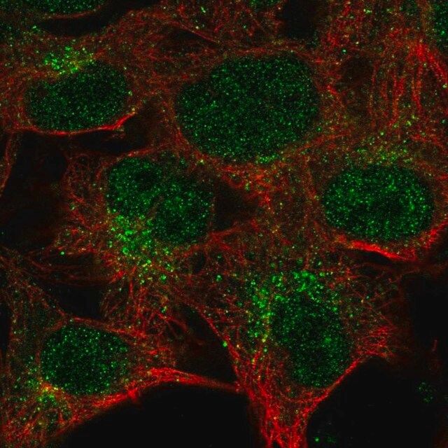 Anti-CTSK antibody produced in rabbit