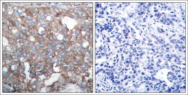 Anti-CTTN (Ab-421) antibody produced in rabbit